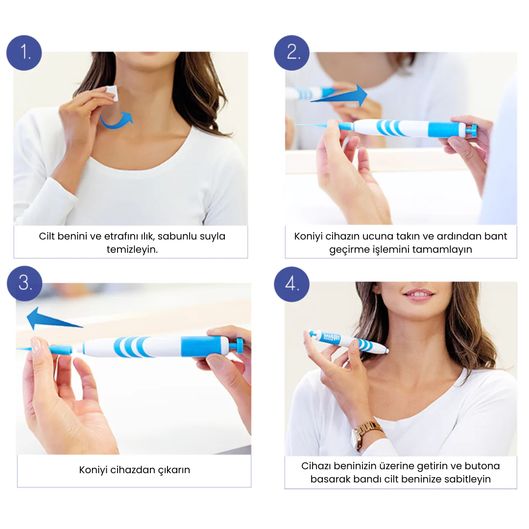 DermaCure™ - Cildinizdeki Benlere Acısız Çözüm